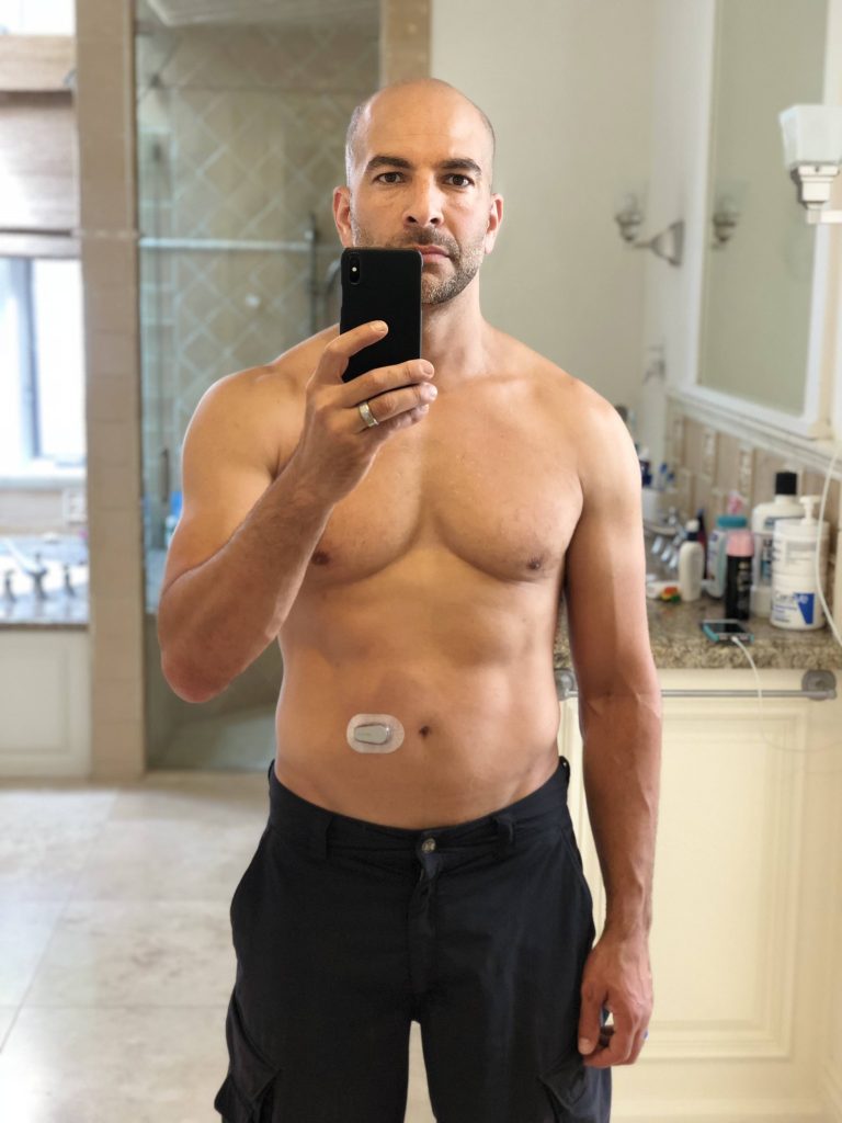 Photo de Peter Attia Torse nu