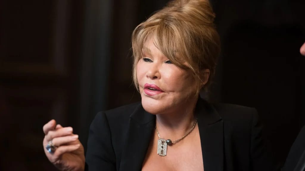 Jocelyne Wildenstein - illustration of the article Jocelyne Wildenstein Fortune